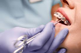 Orthodontist In Nagpur