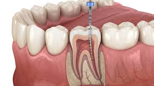 RCT Specialist In Nagpur